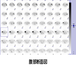 腹部断面図 Image description