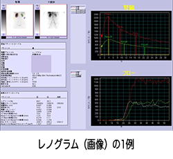 レノグラム画像 Image description
