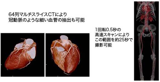 CT画像処理 Image description