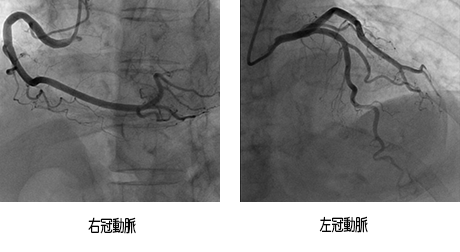 心臓 Image description