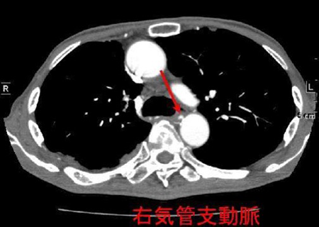 胸部 Image description
