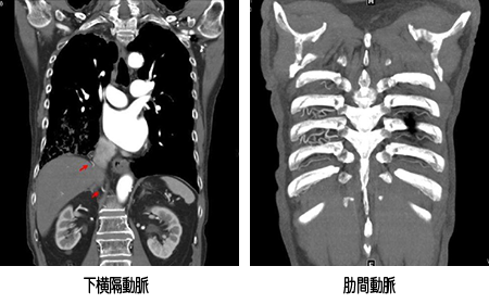胸部 Image description