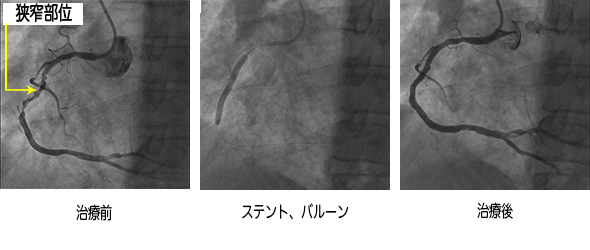 心臓 Image description