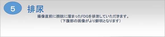 PET検査の流れ Image description