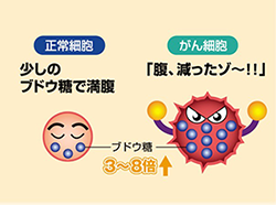 PET/CT Image description