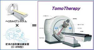放射線治療機器 Image description